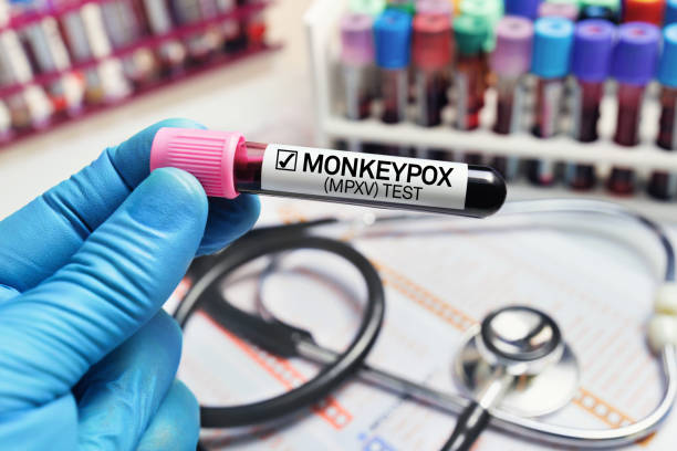 Two more monkeypox cases for Jamaica